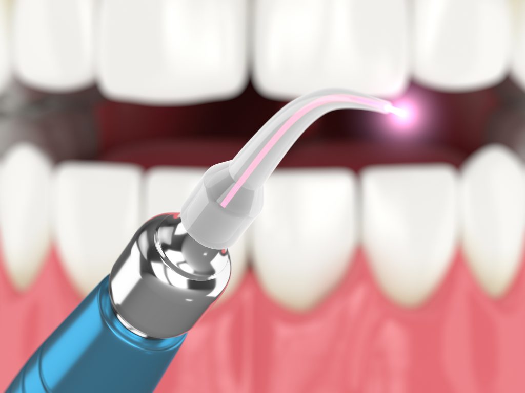 Laser Periodontal therapy Long Island, NY