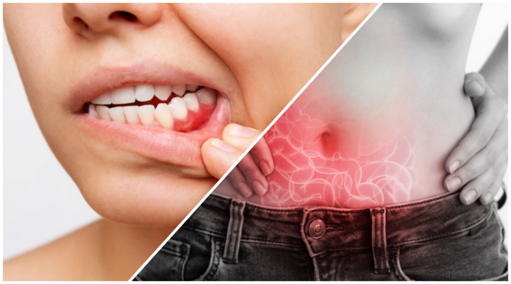 collage of a woman with gum disease and gut issues.