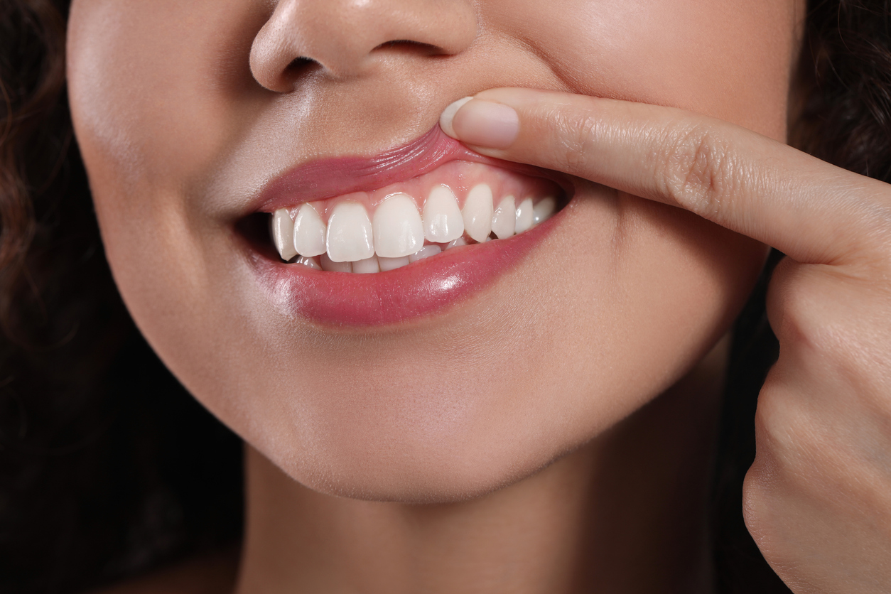 Healthy periodontal (gum) tissues through cosmetic perio
