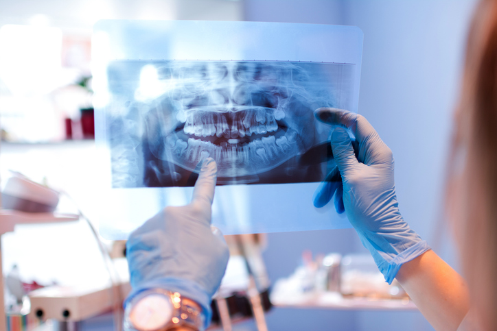 Close-up of a dentist pointing at teeth x-ray image at dental office.