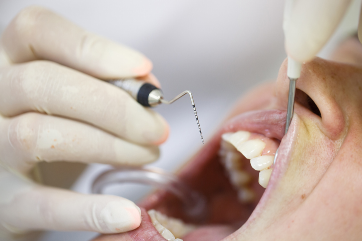 Periodontal Therapy Timeline: Diagnosis, Treatment, and Maintenance